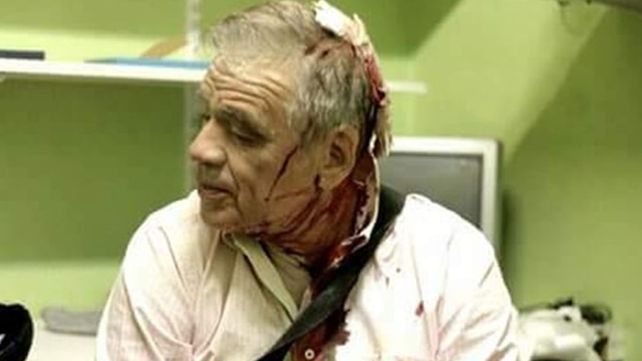 Así le quedó el rostro a Julio Bazán tras la agresión que sufrió frente al Congreso