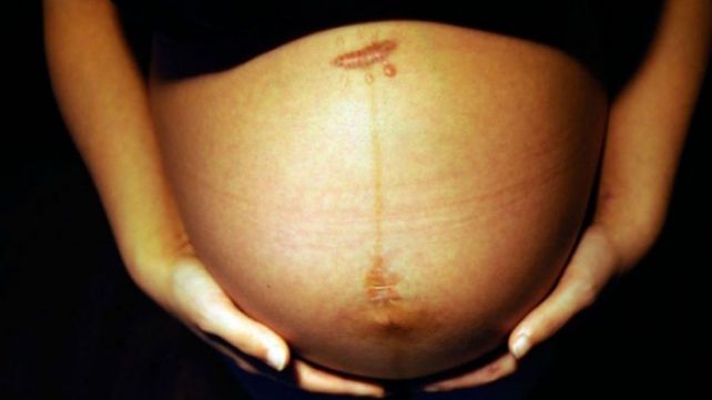 Un caso de estudio: Nació sin vagina, la apuñalaron y quedó embarazada