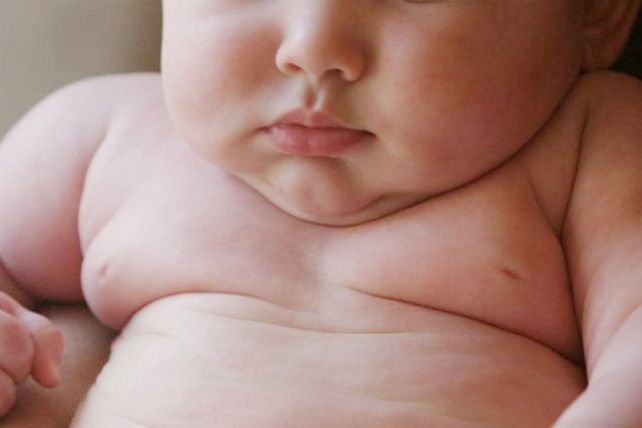 Los bebés nacidos por cesárea tienen más posibilidad de ser obesos
