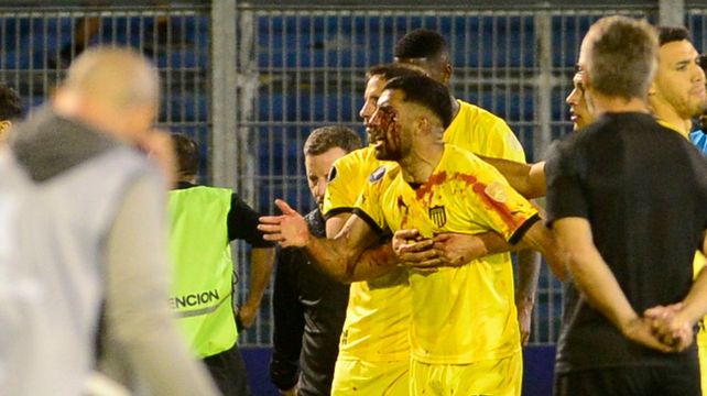 Locura gigante. Maximiliano Olivera fue golpeado en el rostro de un piedrazo.