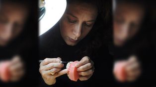 La hermana de Leo Mattioli y su innovadora prótesis dental