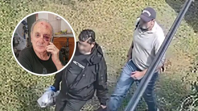 Violencia sin límites en la Costa: golpearon a un abuelo y le rompieron el tabique para entrar a su casa.