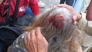 La ONU pidió una investigación sobre el uso indiscriminado de la fuerza durante la protesta de jubilados del 12 de marzo.