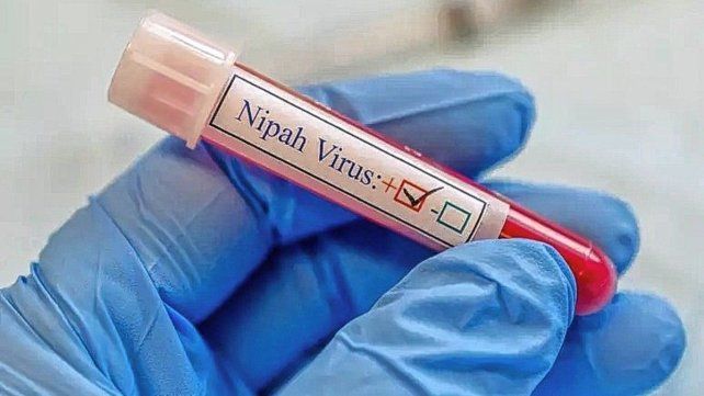 Alerta en India por la muerte de un adolescente por el virus Nipah: advierten sobre su potencial pandémico Alerta en India por la muerte de un adolescente por el virus Nipah: advierten sobre su potencial pandémico