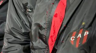 Patronato: un jugador reveló que recibió un culatazo en la cabeza durante el ataque de la barra