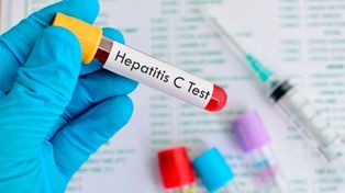 La OMS identifica ya 169 menores enfermos y un fallecimiento por la hepatitis grave de origen desconocido