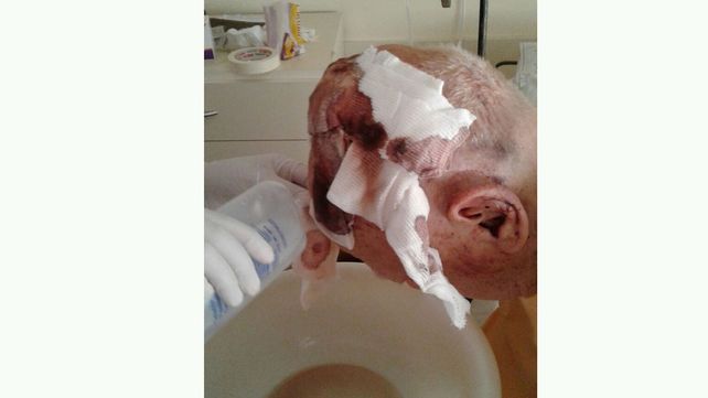Cerrito: salvaje agresión a un almacenero