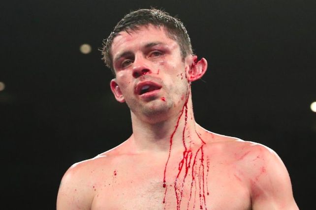 Lesionado. Así le quedó la oreja a Smith tras sufrir una golpiza en el ring.&nbsp;