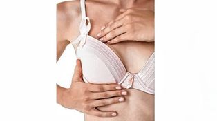 Estadísticas. En la mayoría de las mujeres con cáncer de mama se emplea algún tipo de cirugía como parte del tratamiento.
