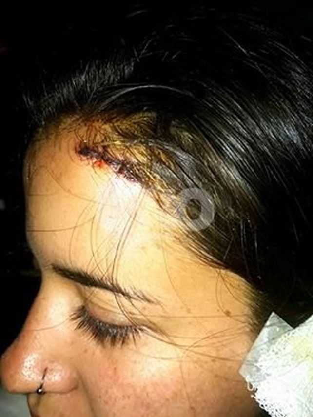 Fue a tomar mates a la Costanera y terminó con cuatro puntos en la cabeza