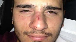 Invocaron a Francisco y golpearon a un gay en una fiesta en San Isidro