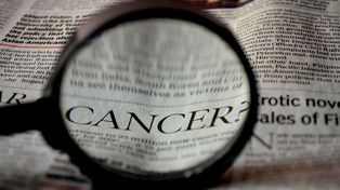 Este año se diagnosticarán 18 millones de nuevos casos de cáncer