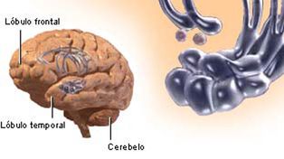 Descubren el sitio del cerebro en el que se origina el amor
