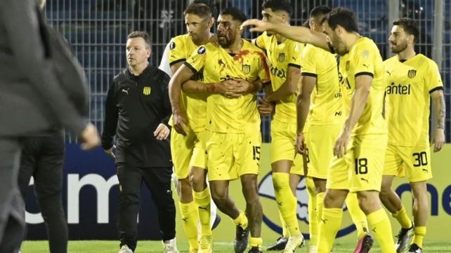 Al finalizar el partido ante Central en el Gigante, el jugador de Peñarol Maximiliano Olivera recibió un piedrazo de un hincha canalla en el pómulo izquierdo.