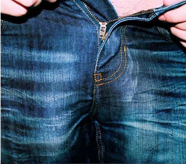 El extraño caso del hombre con dos penes