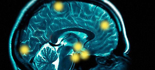 Lograron leer los pensamientos mediante resonancia magn&eacute;tica