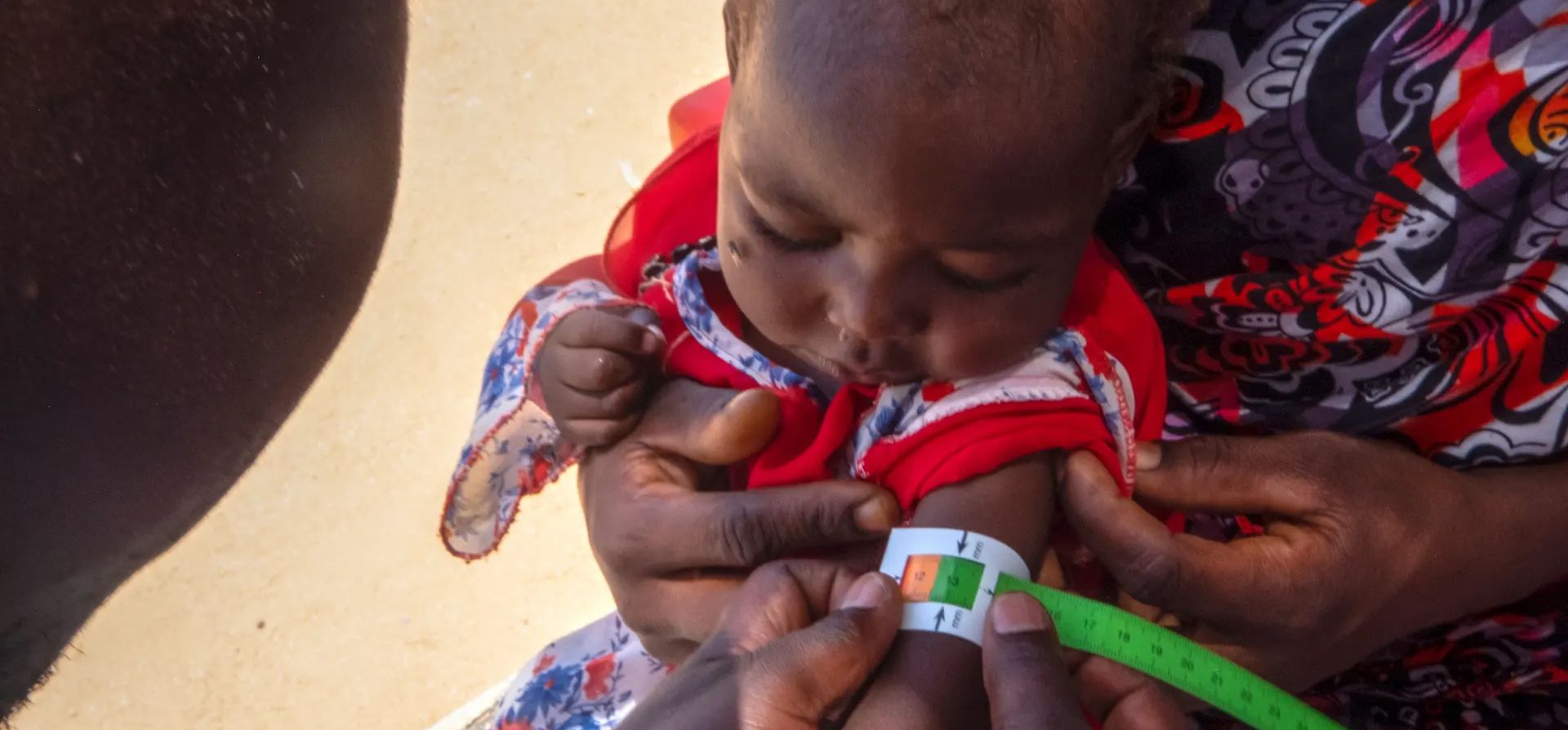 El tamaño del brazo de un niño refugiado sudanés que sufre desnutrición es examinado por un médico en el hospital establecido por la ONG Médicos Sin Fronteras (MSF) en un campo de refugiados. Fotografía: EPA El tamaño del brazo de un niño refugiado sudanés que sufre desnutrición es examinado por un médico en el hospital establecido por la ONG Médicos Sin Fronteras (MSF) en un campo de refugiados. Fotografía: EPA
