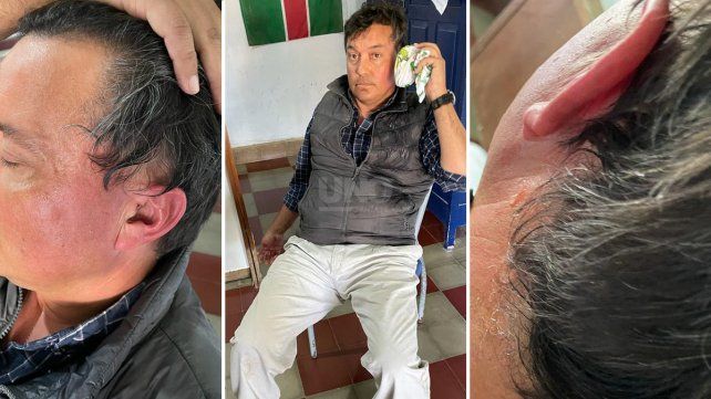 El productor agropecuario agredido por el presidente comunal de Villa Saralegui.