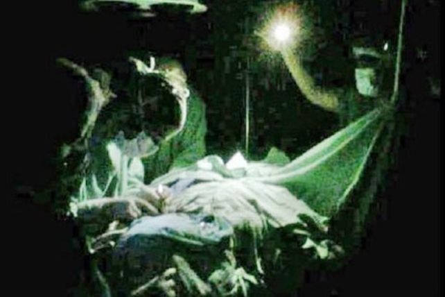 Por un corte de luz, operaron a un chico a la luz de linternas y celulares