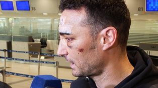 Scaloni regresó al país y habló del accidente que sufrió en España