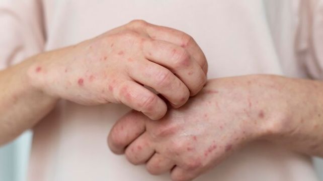 Mendoza reglamentó las denuncias por el incumplimiento de la vacunación en agosto. En el país hubo muertes de niños por tos convulsa