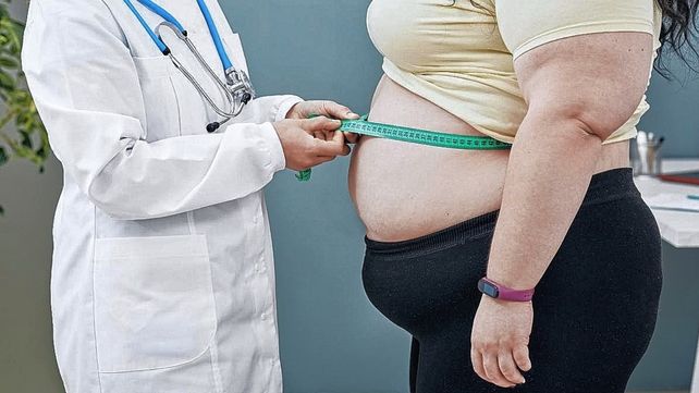 La obesidad es una enfermedad que puede reducir las expectativas de vida de quien la sufre