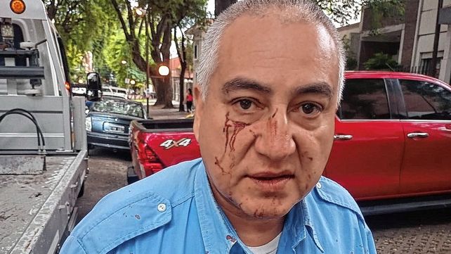En un operativo vehicular, trompearon y lesionaron a un funcionario