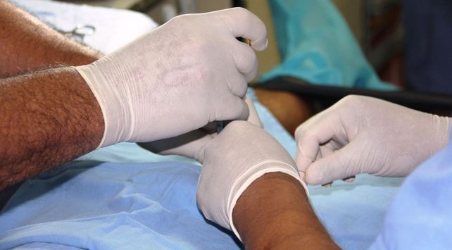 vasectmia procedimiento operación medicos cirujanos cirugía