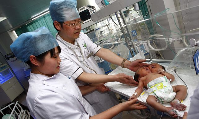Nacen siamesas con un solo cuerpo y dos cabezas en China