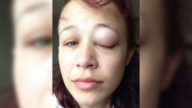 Una modelo se tatuó el ojo y le pasó lo peor
