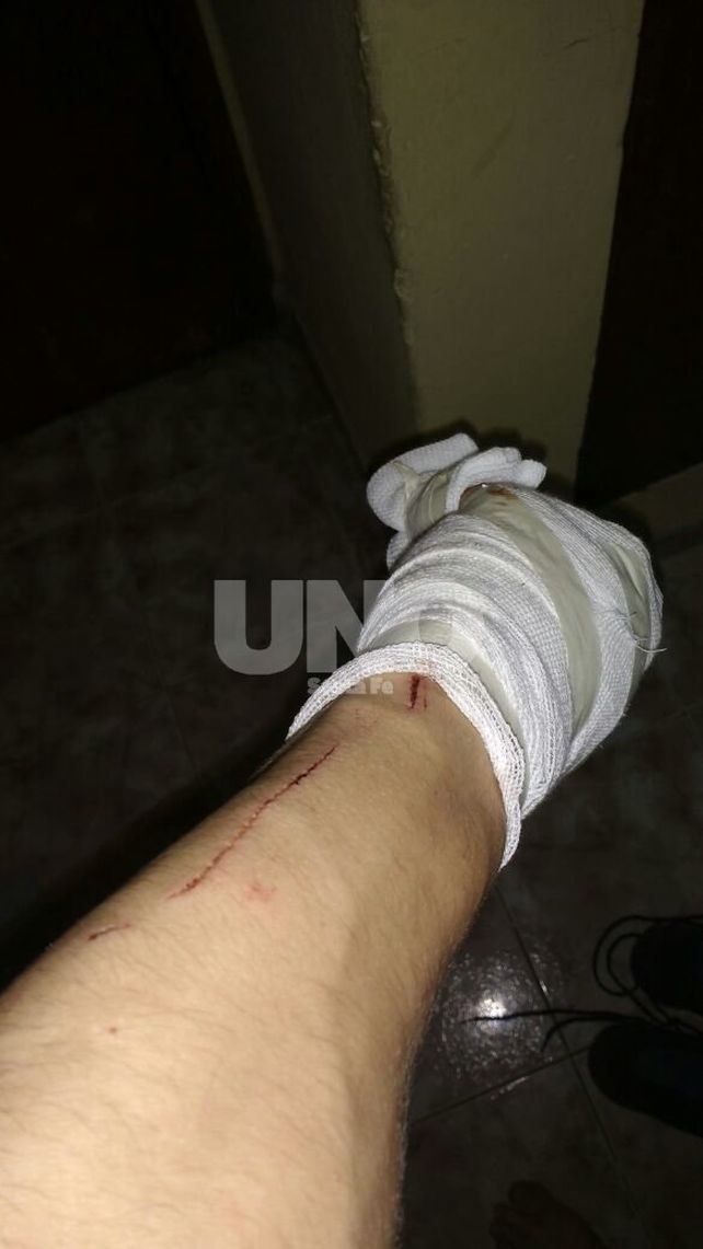 Grave lesión a un policía durante la aprehensión de un violento delincuente