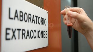 ¿Por qué es importante donar sangre de manera voluntaria y frecuente?