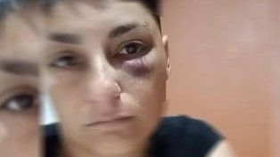 El relato de una víctima de violencia de género: Me asfixió y me dijo que me iba a matar