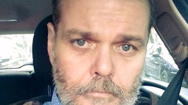 Alfredo Casero recibió un disparo de parte de un taxista