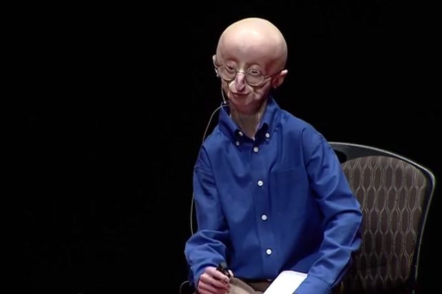 Adolescente envejeció y murió a los 17 años