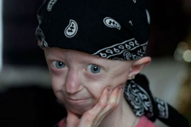 A los 17 años murió la adolescente más vieja del mundo