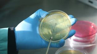 Investigadores del Inta desarrollaron una vacuna contra la Escherichia coli en bovinos
