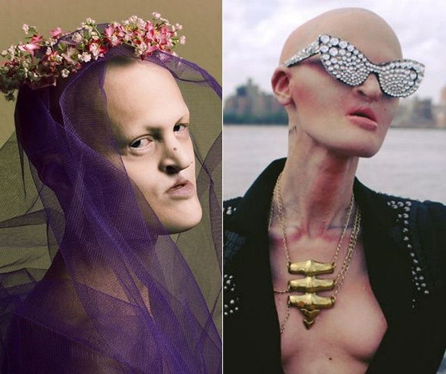 Conocé a la modelo internacional con una mutación genética única