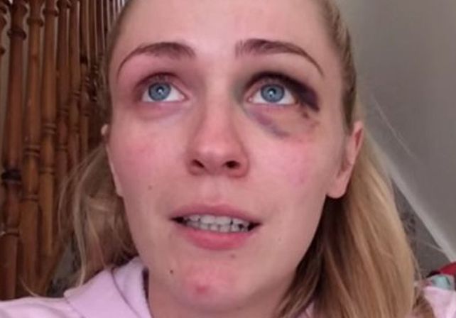 Su marido le era infiel y le pegaba: contó su calvario en un video