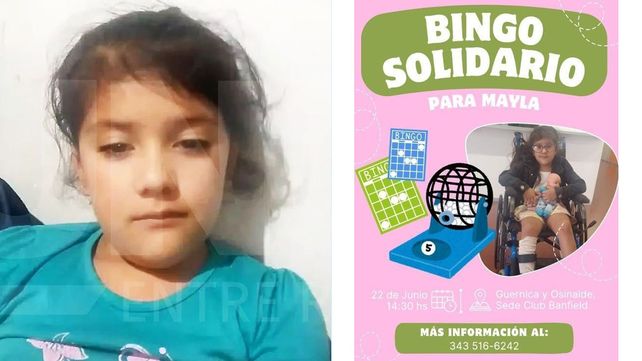 Realizan un mate bingo para costear la cirugía de Mayla