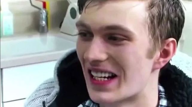 Mostró sus dientes luego de 20 años sin lavárselos