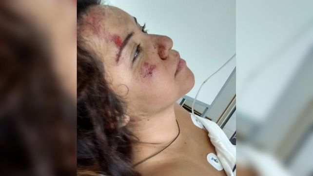 La joven que fue atropellada y abandonada se siente atrapada en Rosario