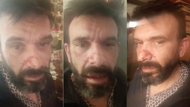 Reclaman que se investigue la agresión homofóbica sufrida por un escritor