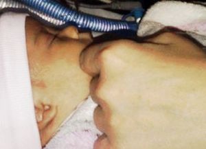 Luz Milagros, la beba dada por muerta al nacer, ya está en su casa