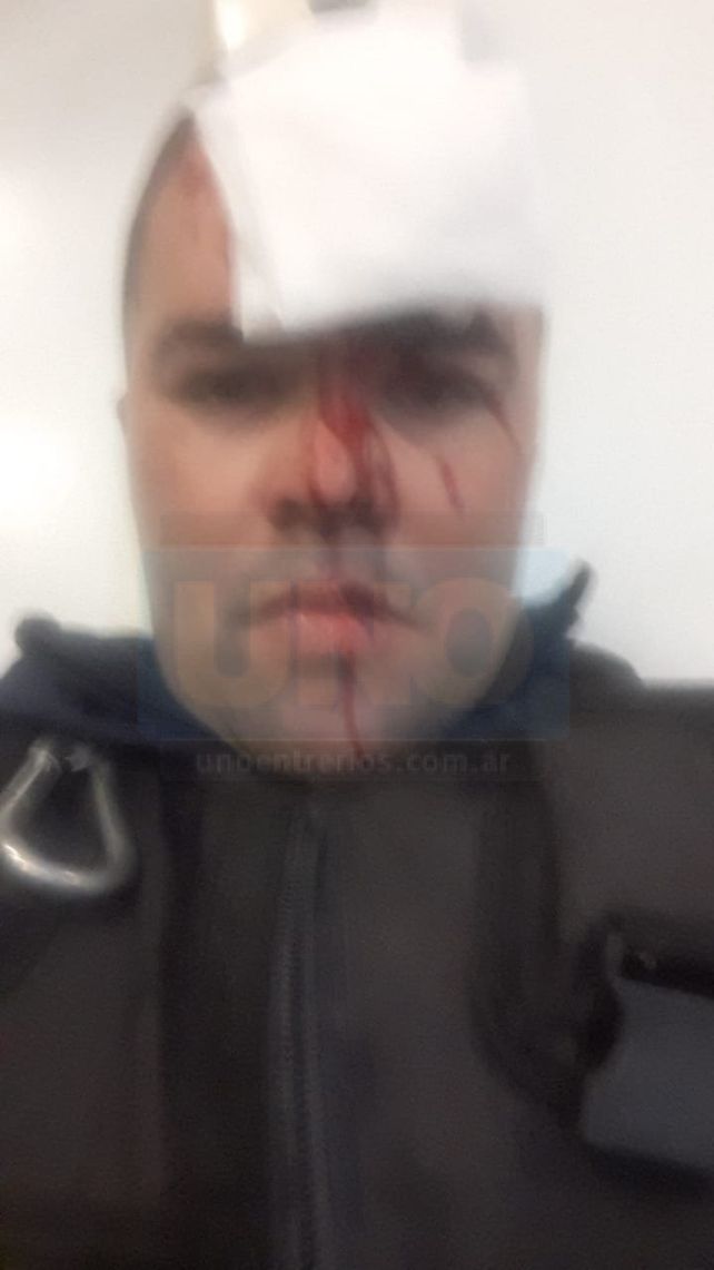 Internado. Uno de los policías debió ser internado. Le rompieron un vaso en la cabeza.