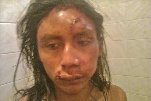 Golpearon e hirieron al hijo del cacique Félix Diaz