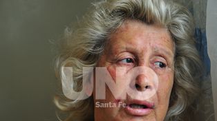 Asaltan y golpean brutalmente a la dueña de un motel de barrio Candioti