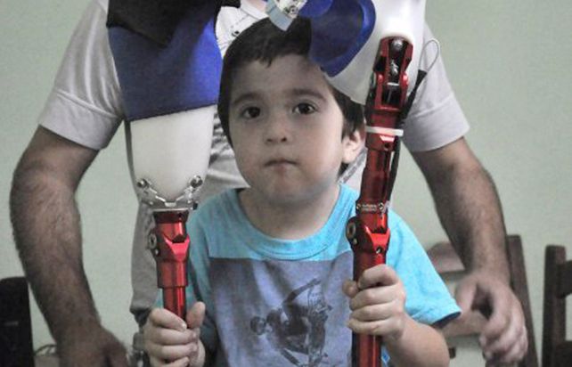 El chico al que le robaron las prótesis recibió una donación y volverá a caminar