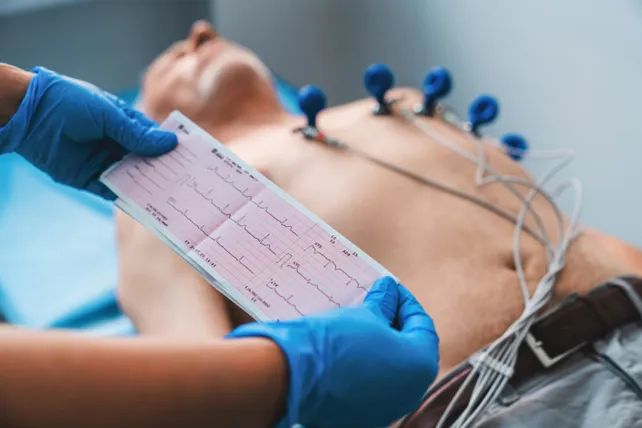 Las enfermedades cardiovasculares siguen siendo una de las principales causas de muerte en hombres