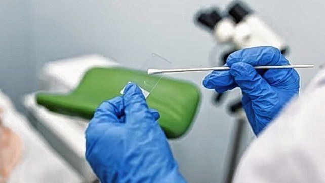 El agente causal del cáncer de cuello uterino es el Virus del Papiloma Humano (VPH). Desde la provincia refuerzan tareas de prevención